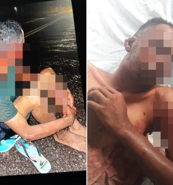 Homem é atacado por cães e transferido para hospital em Piripiri