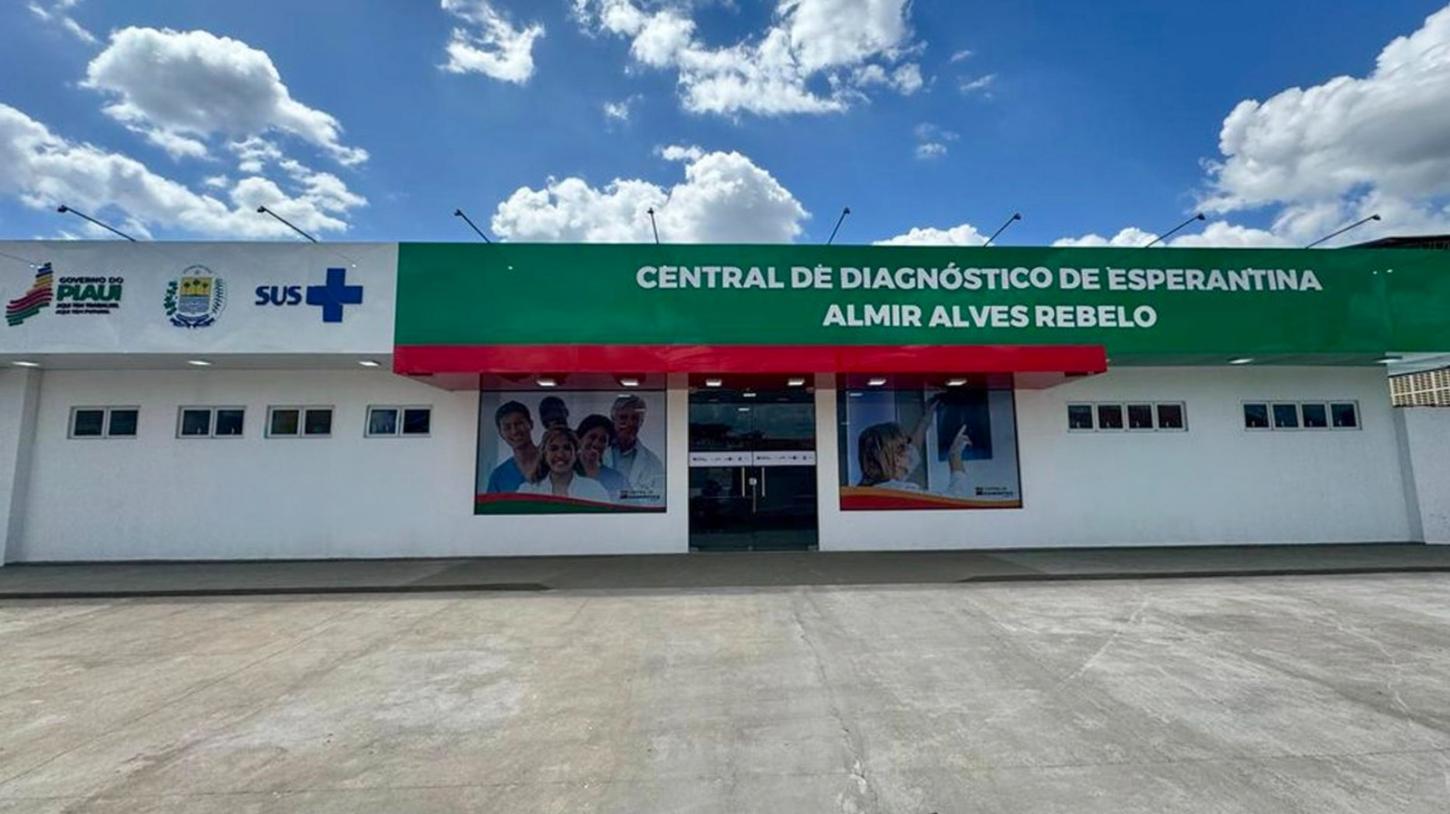 Central de Diagnóstico de Esperantina realiza mais de 45 mil procedimentos e Dia D da Mamografia, em 2025
