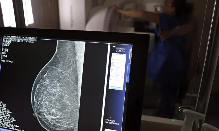 Médicos lançam guia para evitar recusa de mamografia digital
